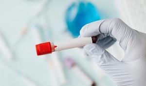 sepsis-sessiz-bir-tehdit-ve-guncel-bilgilendirme-SWehueOQ.jpg